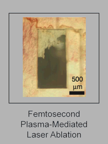 Femtosecond
                        Plasma Mediated Ablation