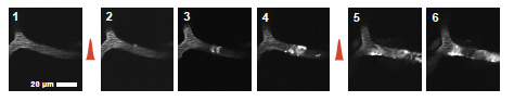Microvessel Occlusion With Laser
